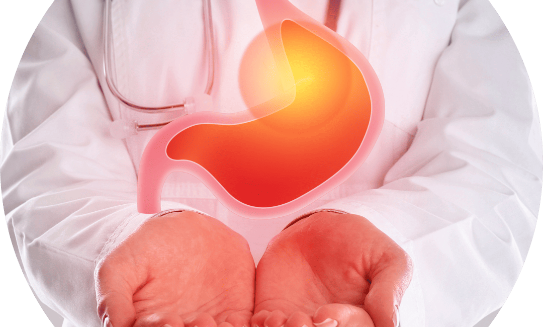 Refluxo gastroesofágico​ (2)