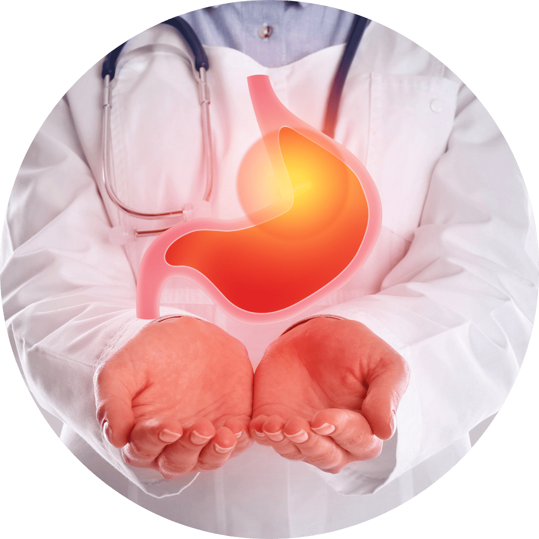 Refluxo gastroesofágico​ (2)