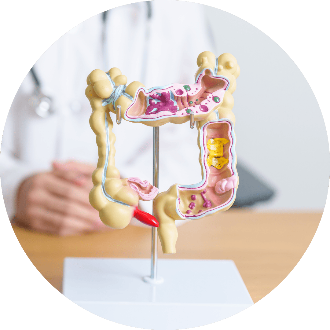 Doenças Intestinais
